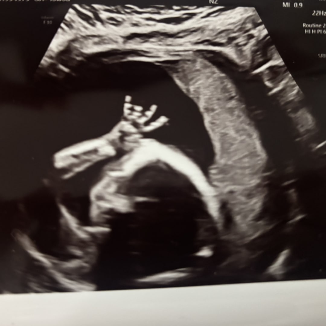 Photo shared by Marti for their Babylist baby registry.