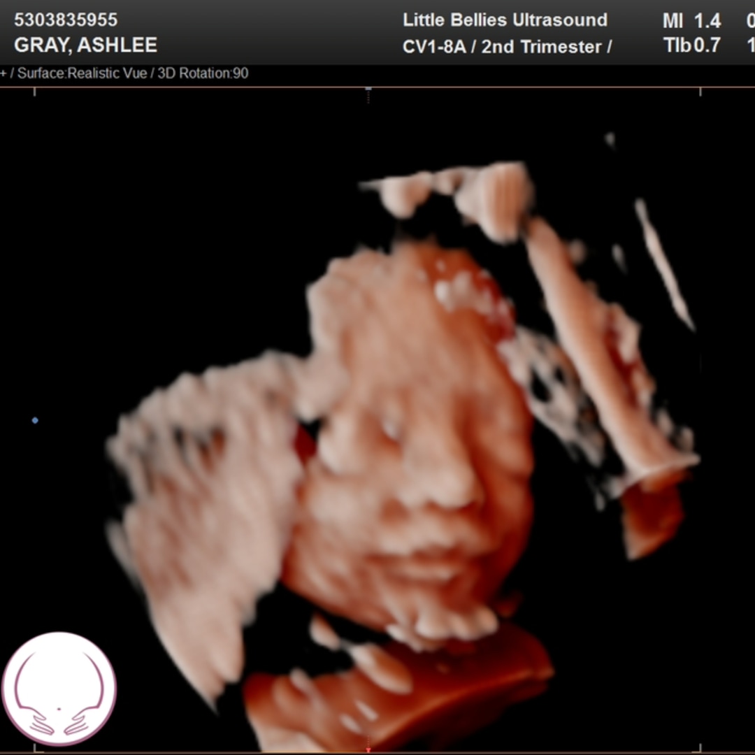 Photo shared by Ashlee for their Babylist baby registry.