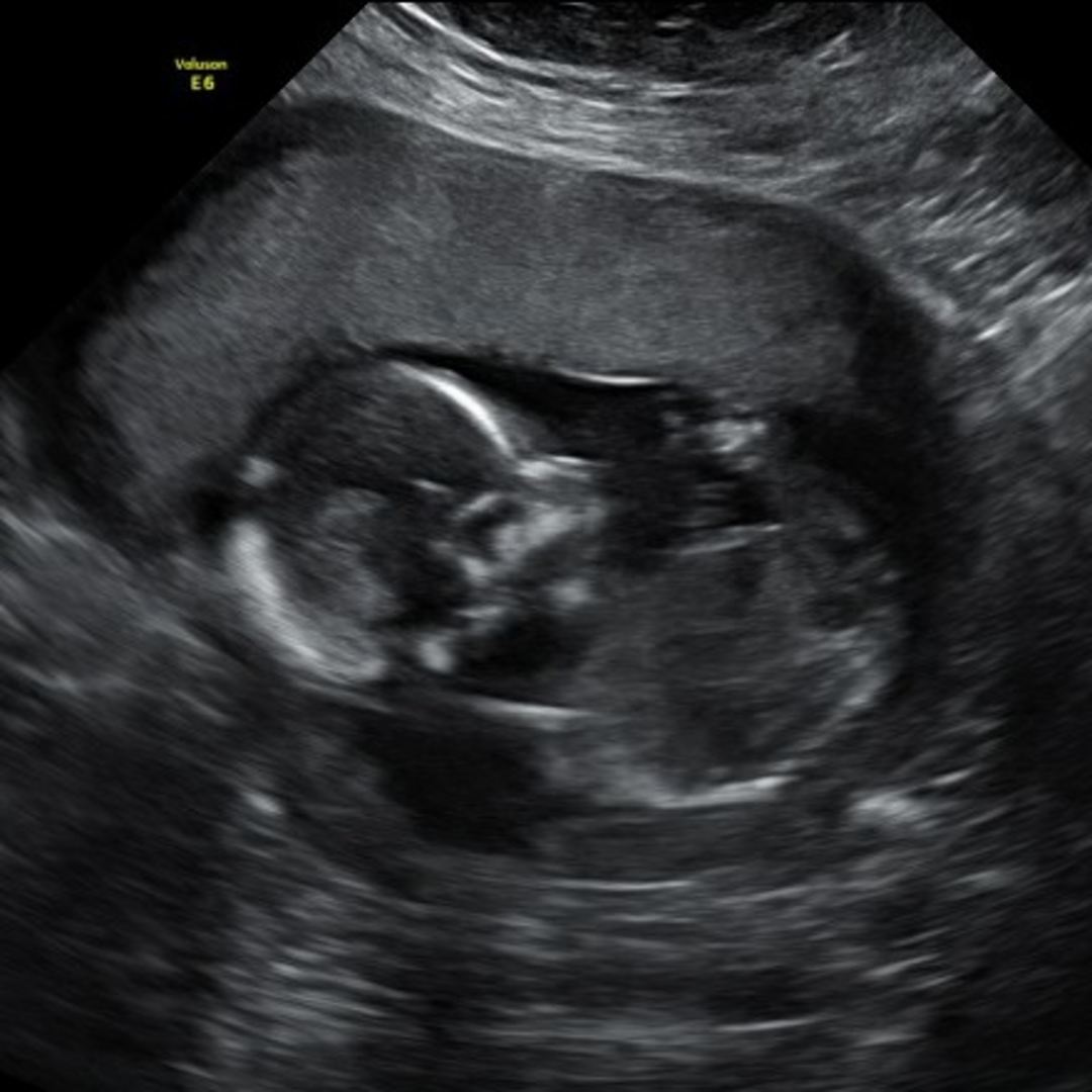Photo shared by Karina for their Babylist baby registry.