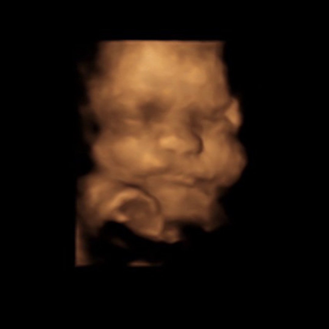 Photo shared by Haley for their Babylist baby registry.