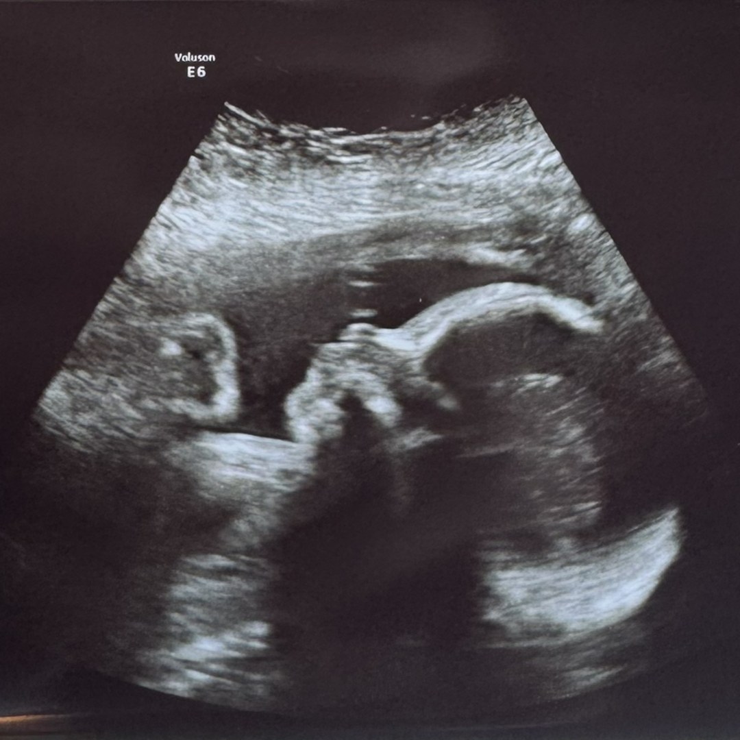 Photo shared by Kaylee for their Babylist baby registry.