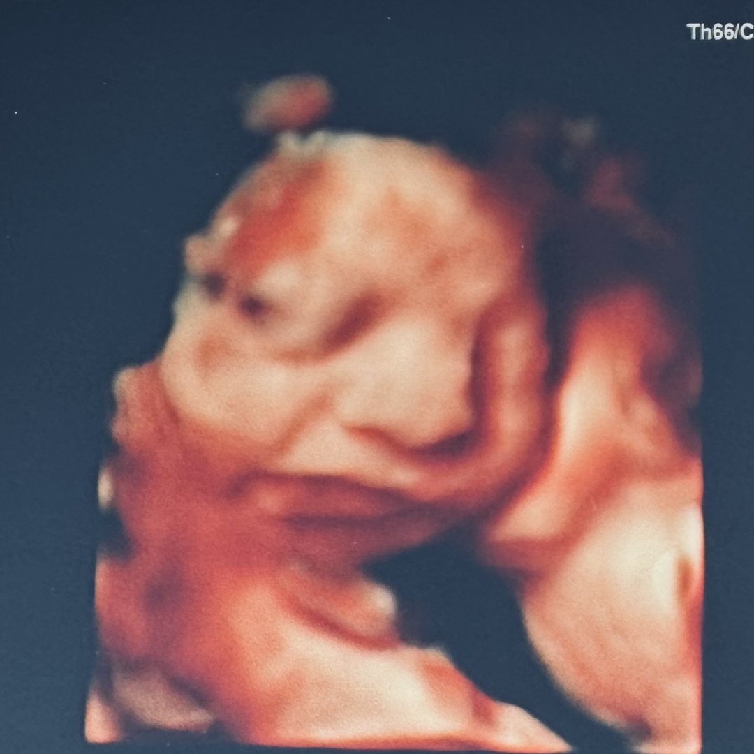 Photo shared by Stephanie for their Babylist baby registry.