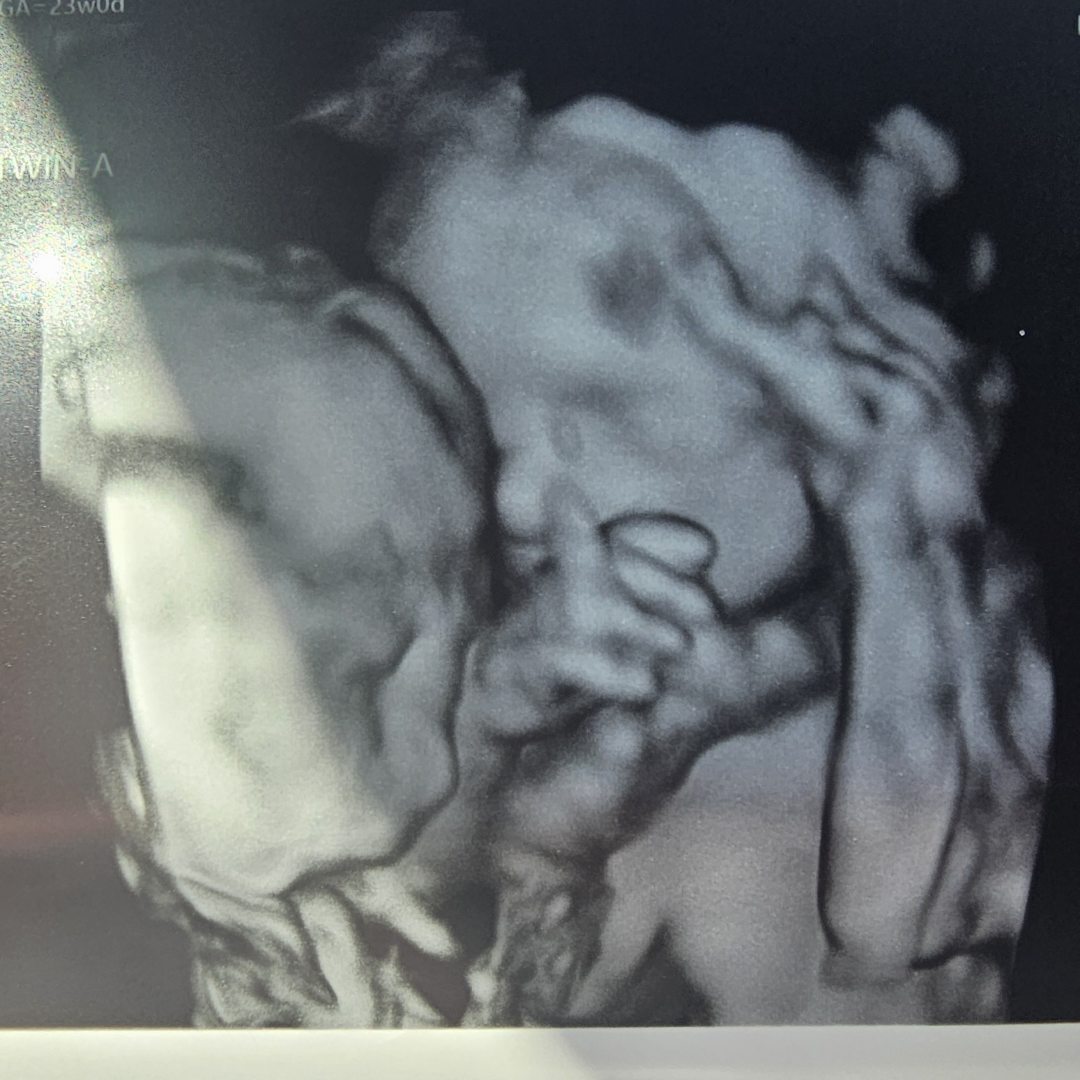 Photo shared by Amber for their Babylist baby registry.