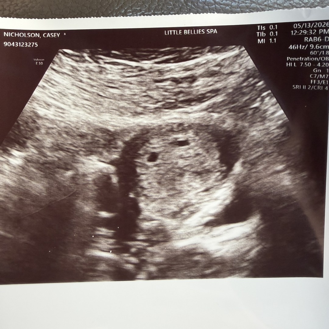 Photo shared by Casey for their Babylist baby registry.