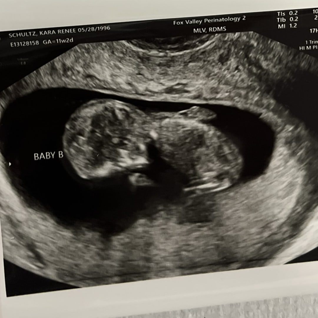 Photo shared by Kara for their Babylist baby registry.