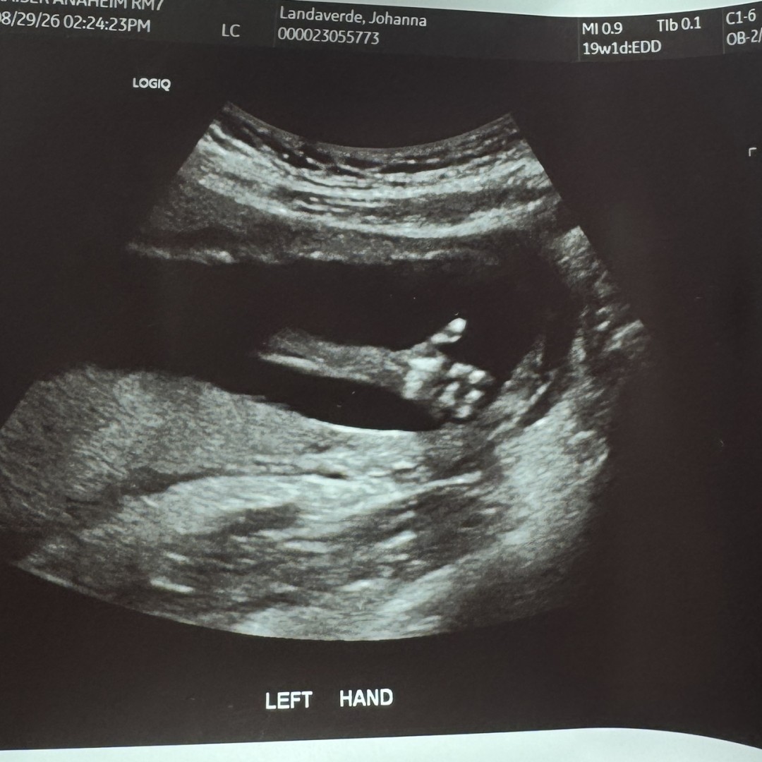 Photo shared by Johanna for their Babylist baby registry.