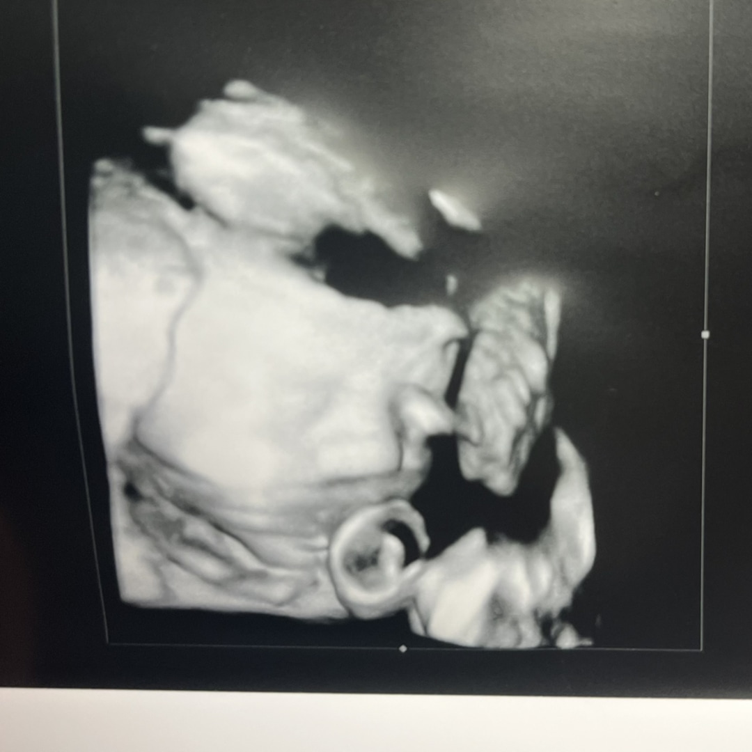 Photo shared by Annabelle for their Babylist baby registry.