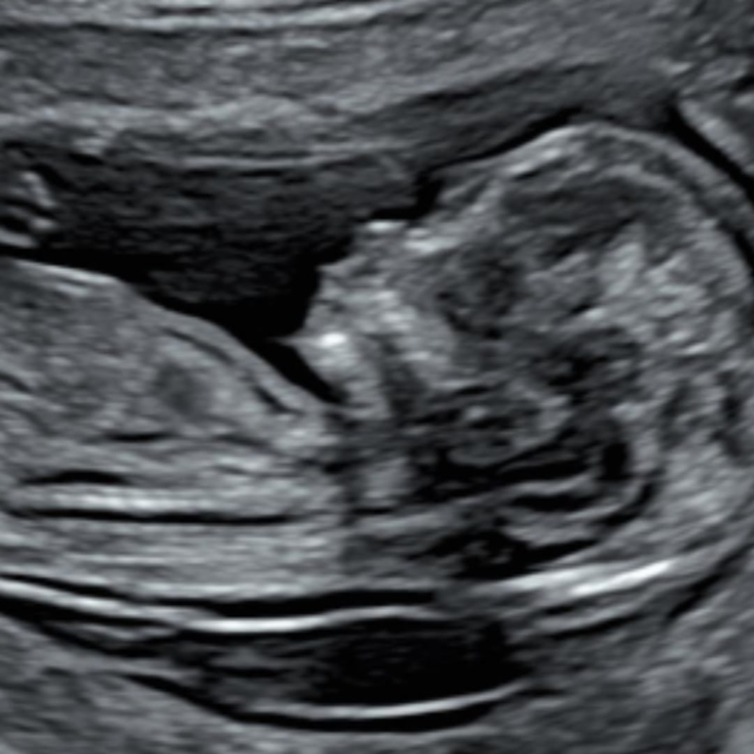 Photo shared by Crystal for their Babylist baby registry.