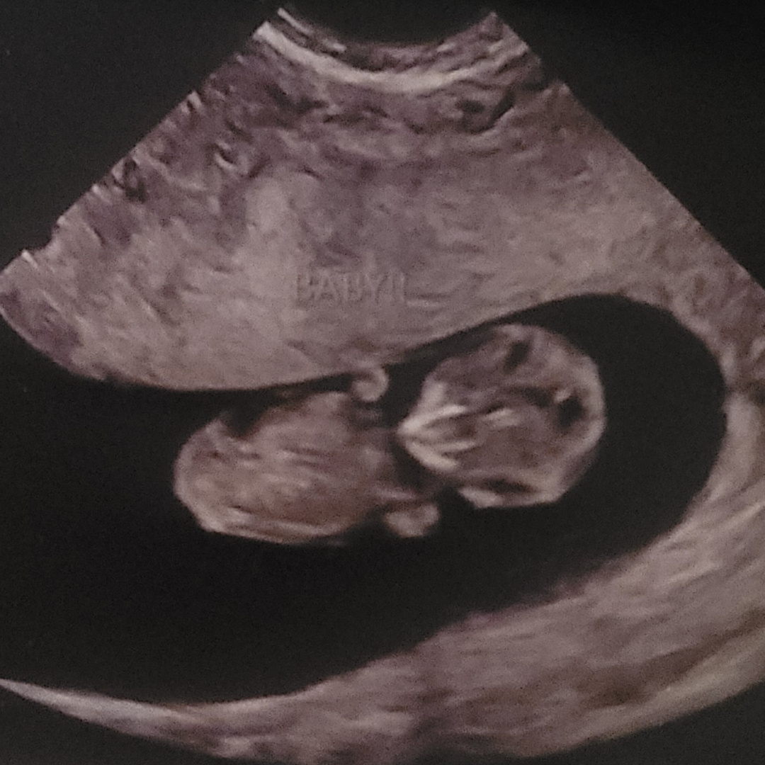 Photo shared by Valerie for their Babylist baby registry.