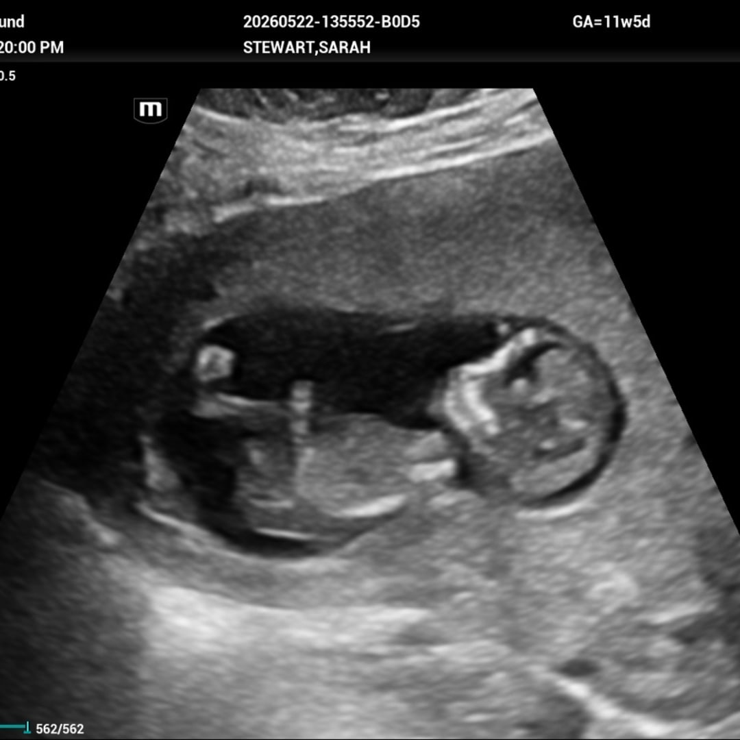 Photo shared by Sarah for their Babylist baby registry.