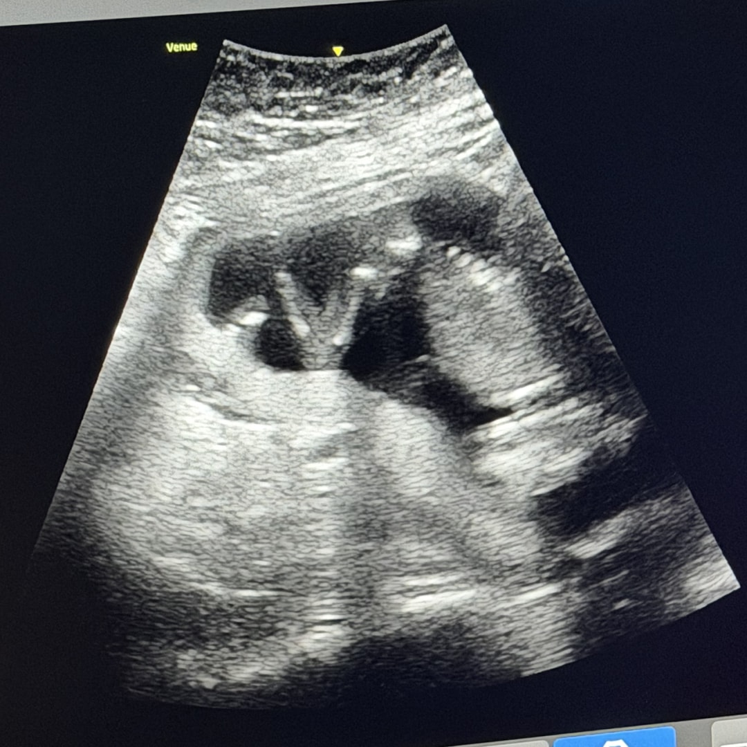 Photo shared by Logan for their Babylist baby registry.