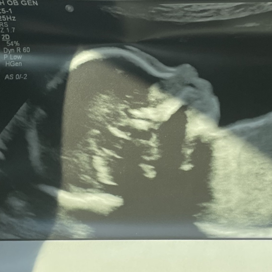 Photo shared by Nathaly for their Babylist baby registry.