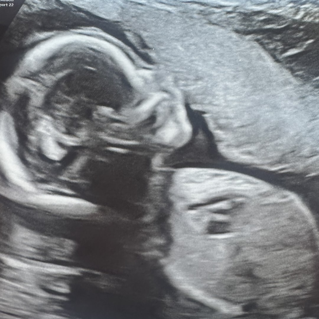 Photo shared by Gabriella for their Babylist baby registry.