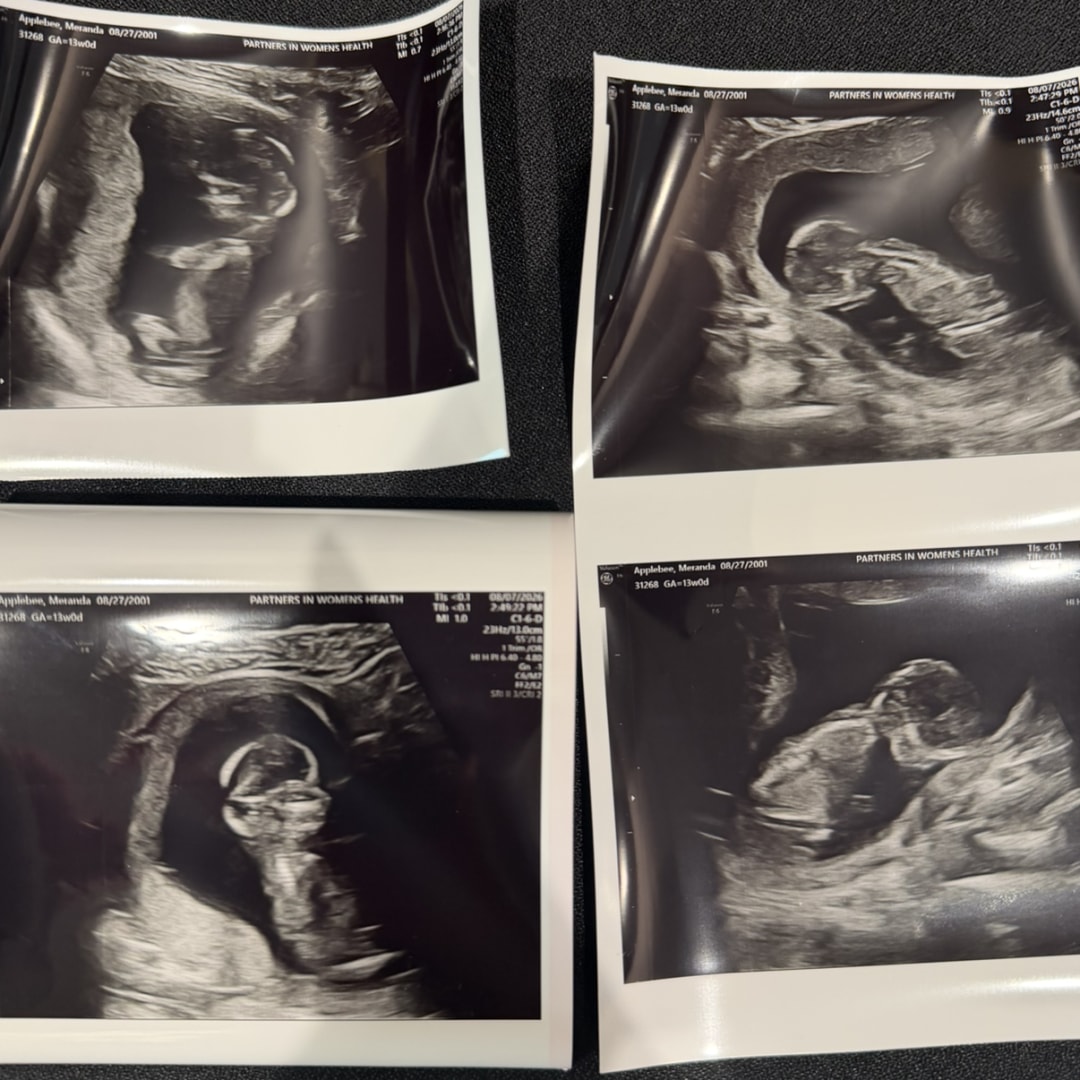 Photo shared by Meranda for their Babylist baby registry.
