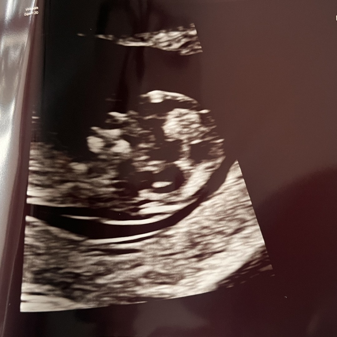 Photo shared by Taylor for their Babylist baby registry.