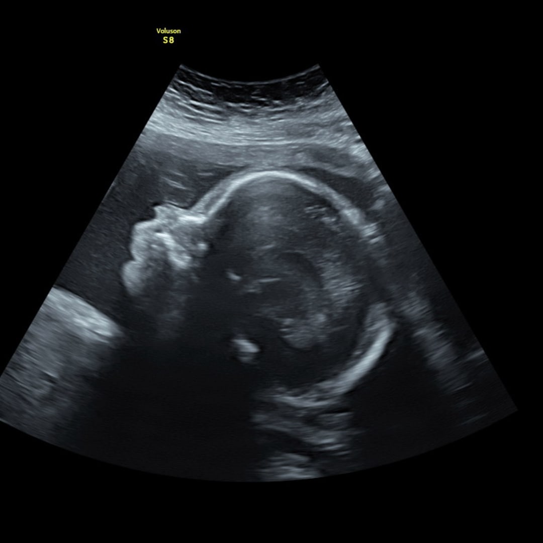 Photo shared by Annastasia for their Babylist baby registry.