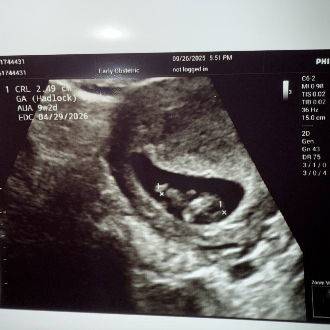 Photo shared by Jocelyn for their Babylist baby registry.