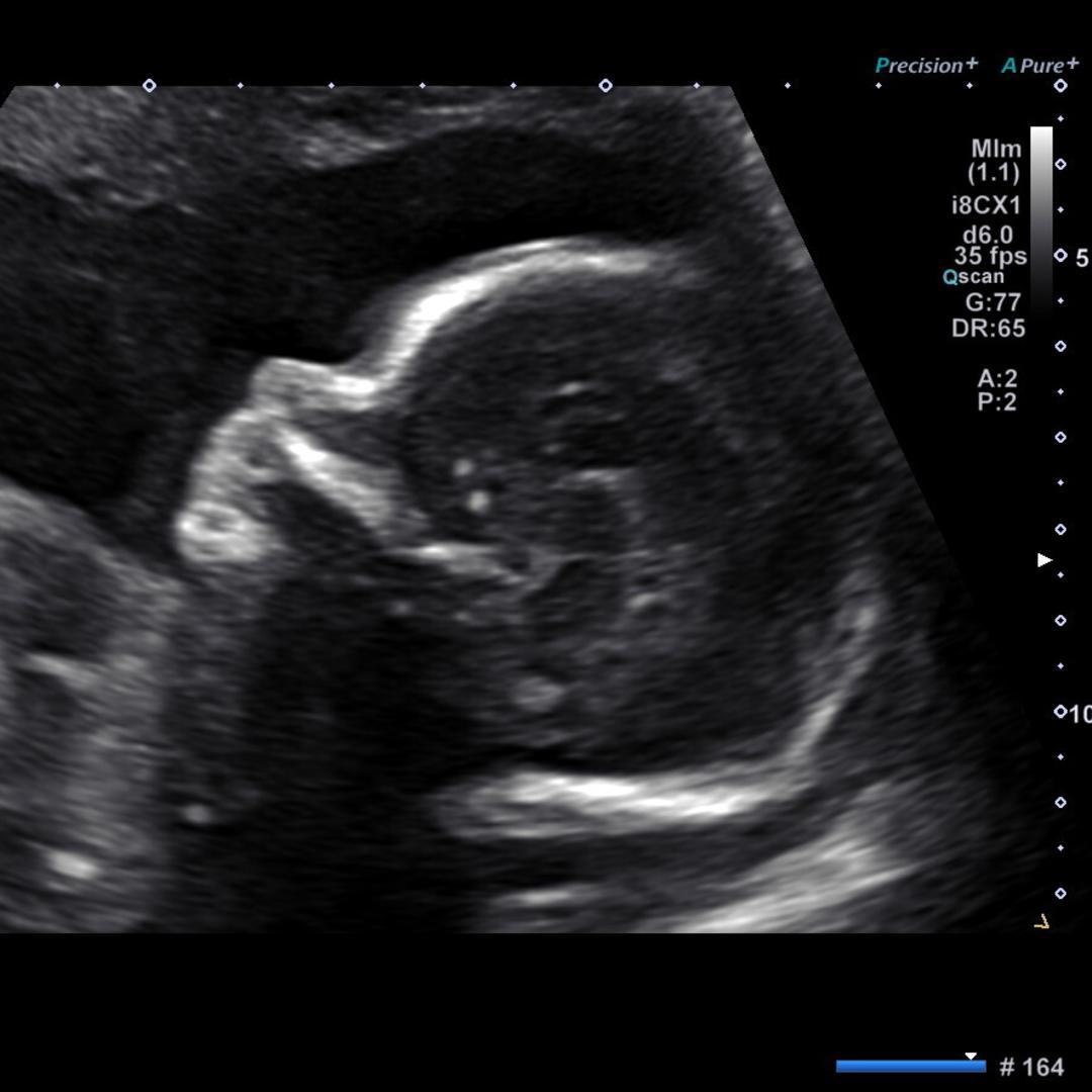 Photo shared by Sarah for their Babylist baby registry.