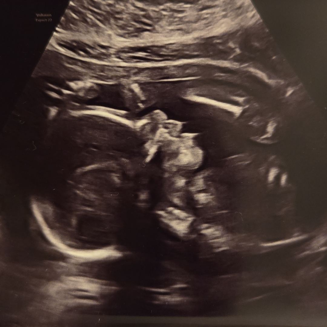 Photo shared by Leneli for their Babylist baby registry.