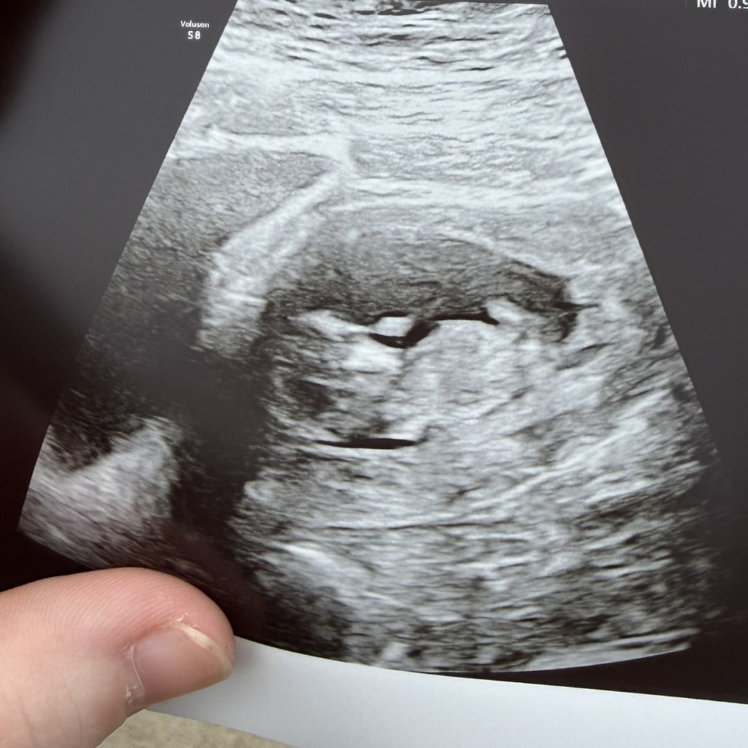 Photo shared by Christal for their Babylist baby registry.