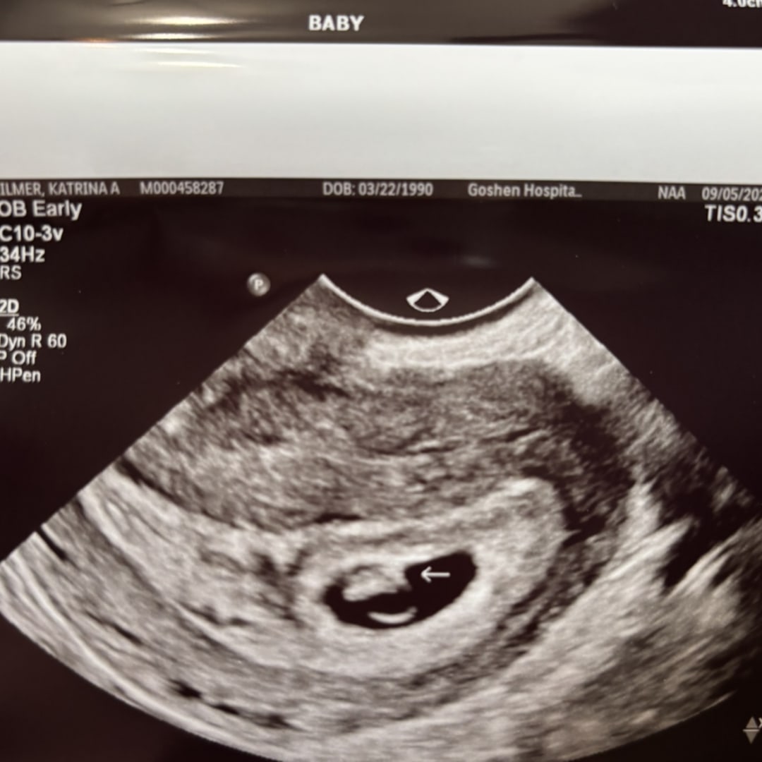 Photo shared by Katrina for their Babylist baby registry.