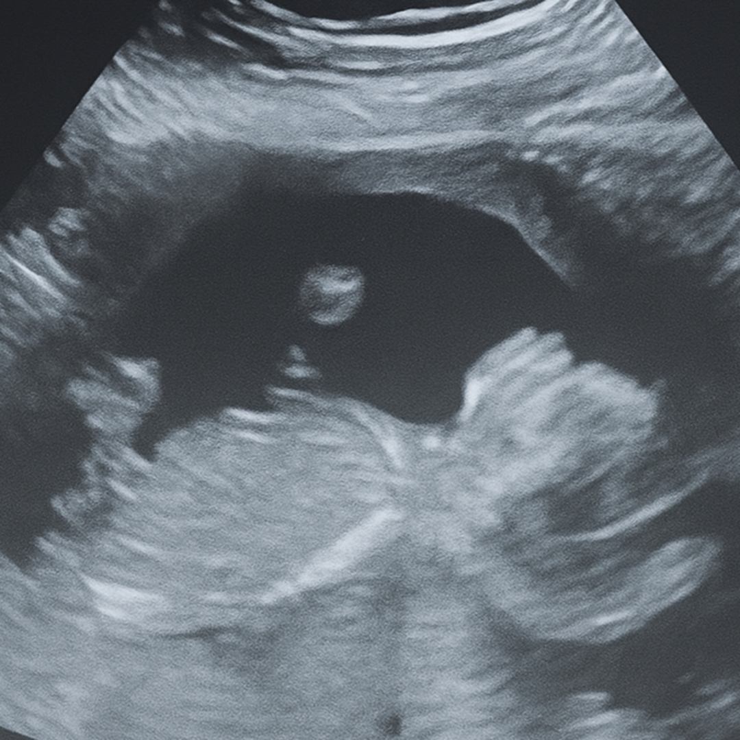 Photo shared by Danielle for their Babylist baby registry.