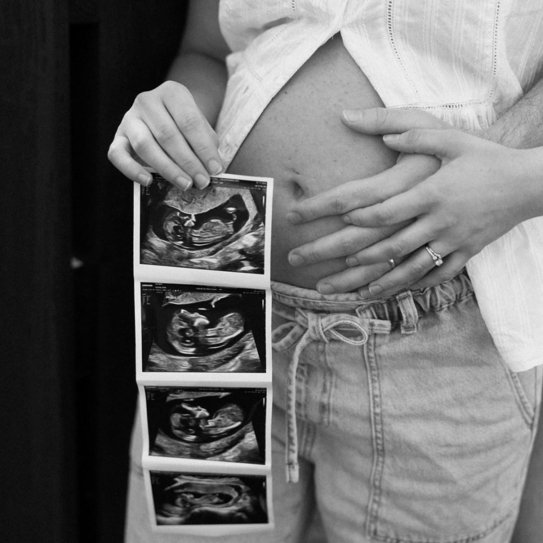 Photo shared by Erin for their Babylist baby registry.