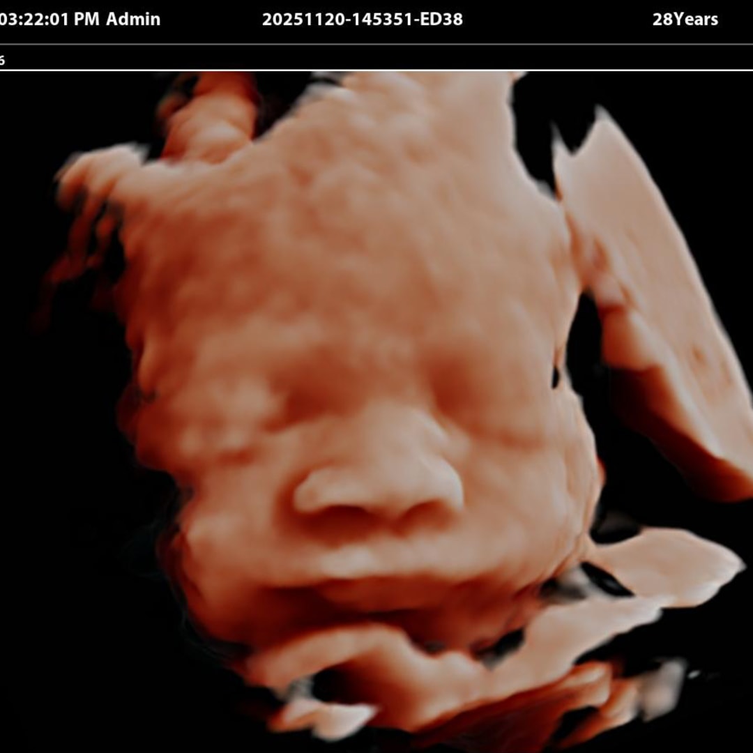 Photo shared by Norimar for their Babylist baby registry.