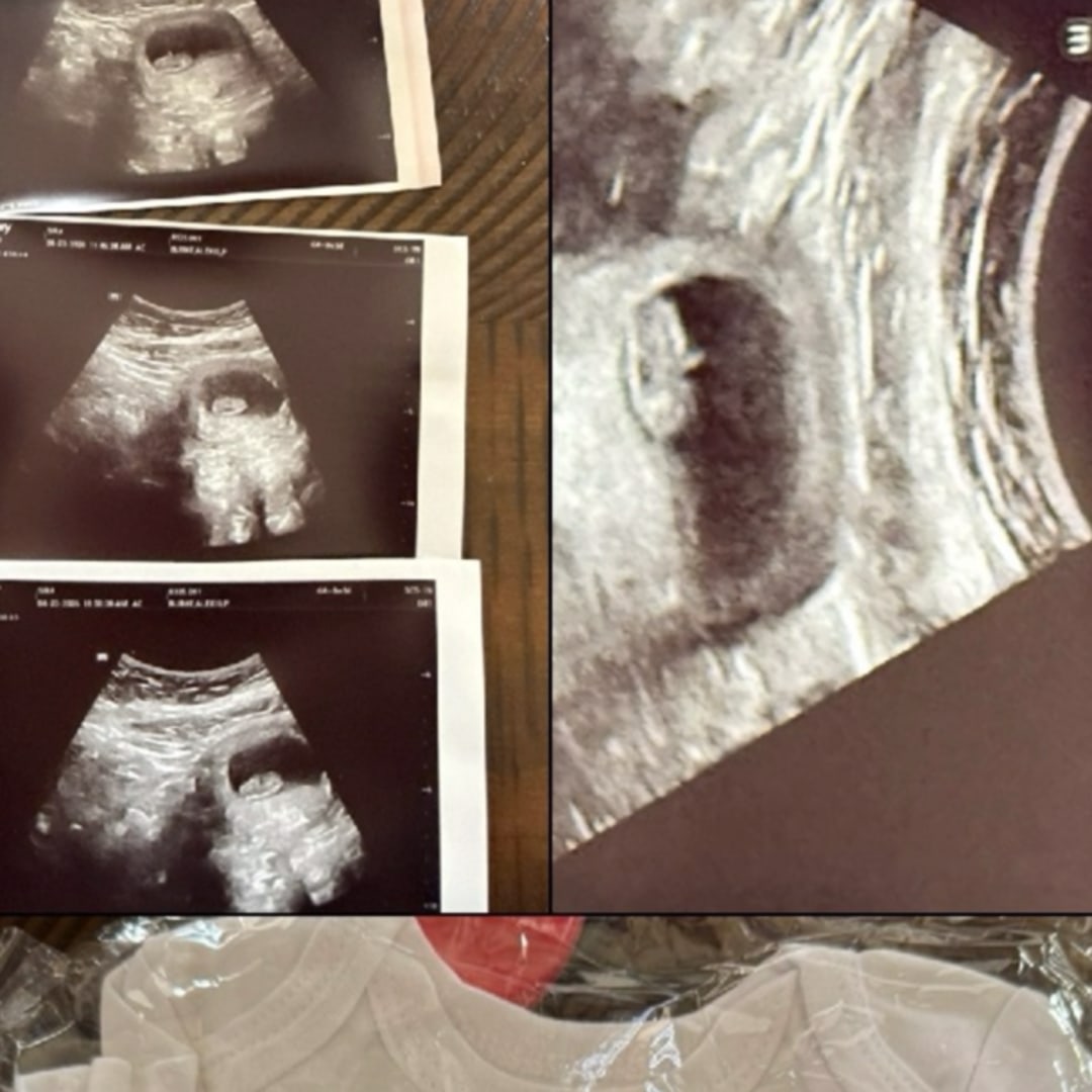 Photo shared by Alexis for their Babylist baby registry.
