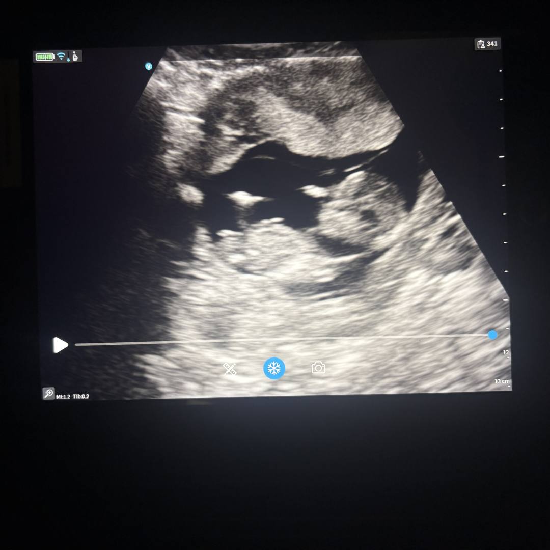 Photo shared by Emma for their Babylist baby registry.