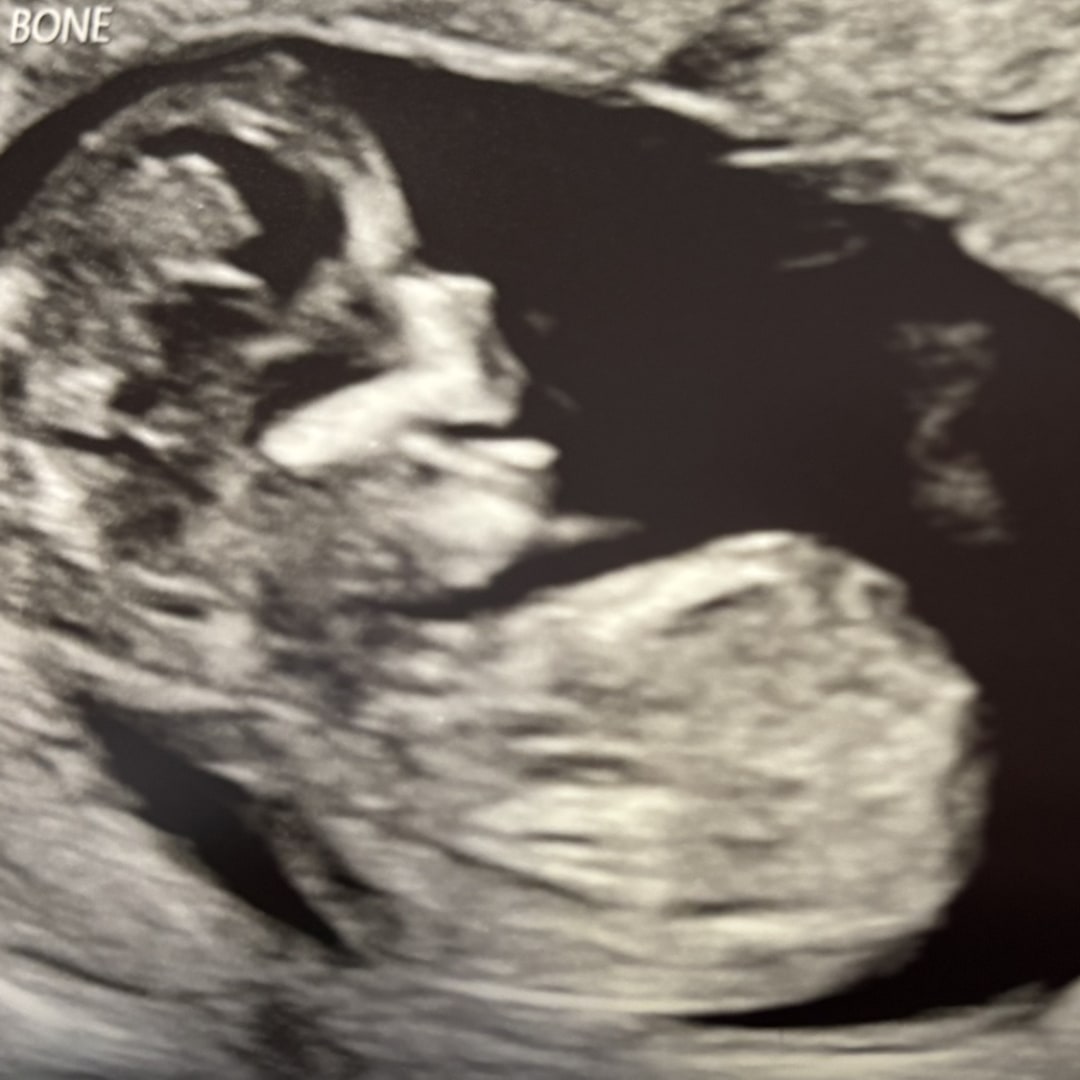 Photo shared by Chris & Lexi for their Babylist baby registry.