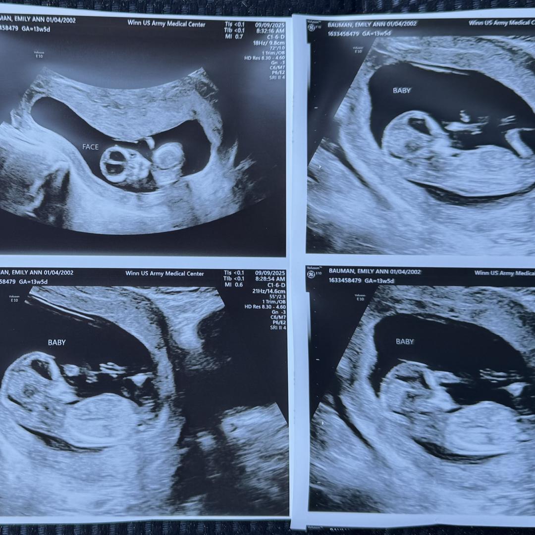 Photo shared by Emily for their Babylist baby registry.