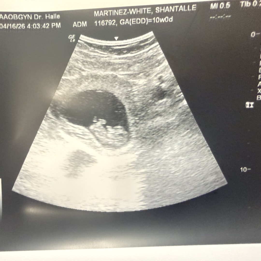Photo shared by Shantalle for their Babylist baby registry.