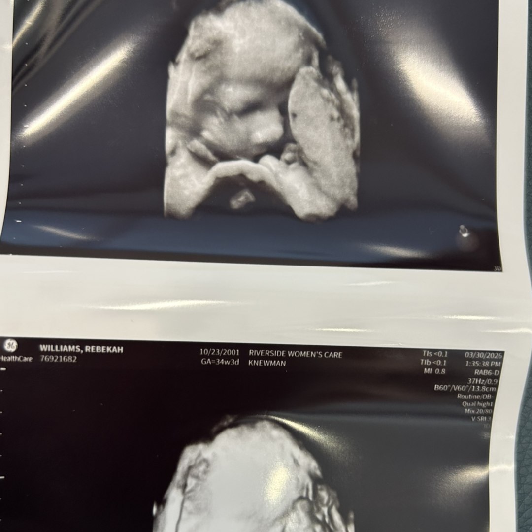 Photo shared by Rebekah for their Babylist baby registry.