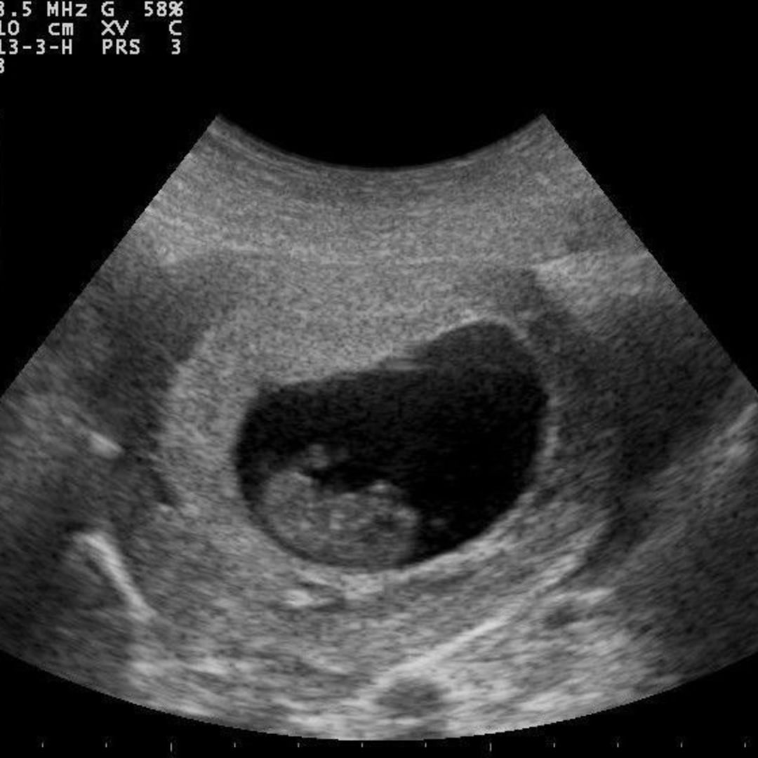 Photo shared by Lia for their Babylist baby registry.