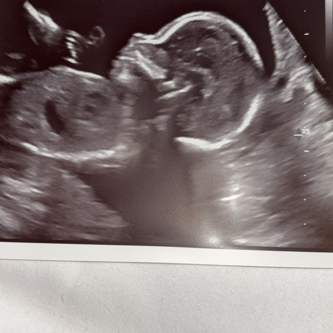 Photo shared by Daonna for their Babylist baby registry.