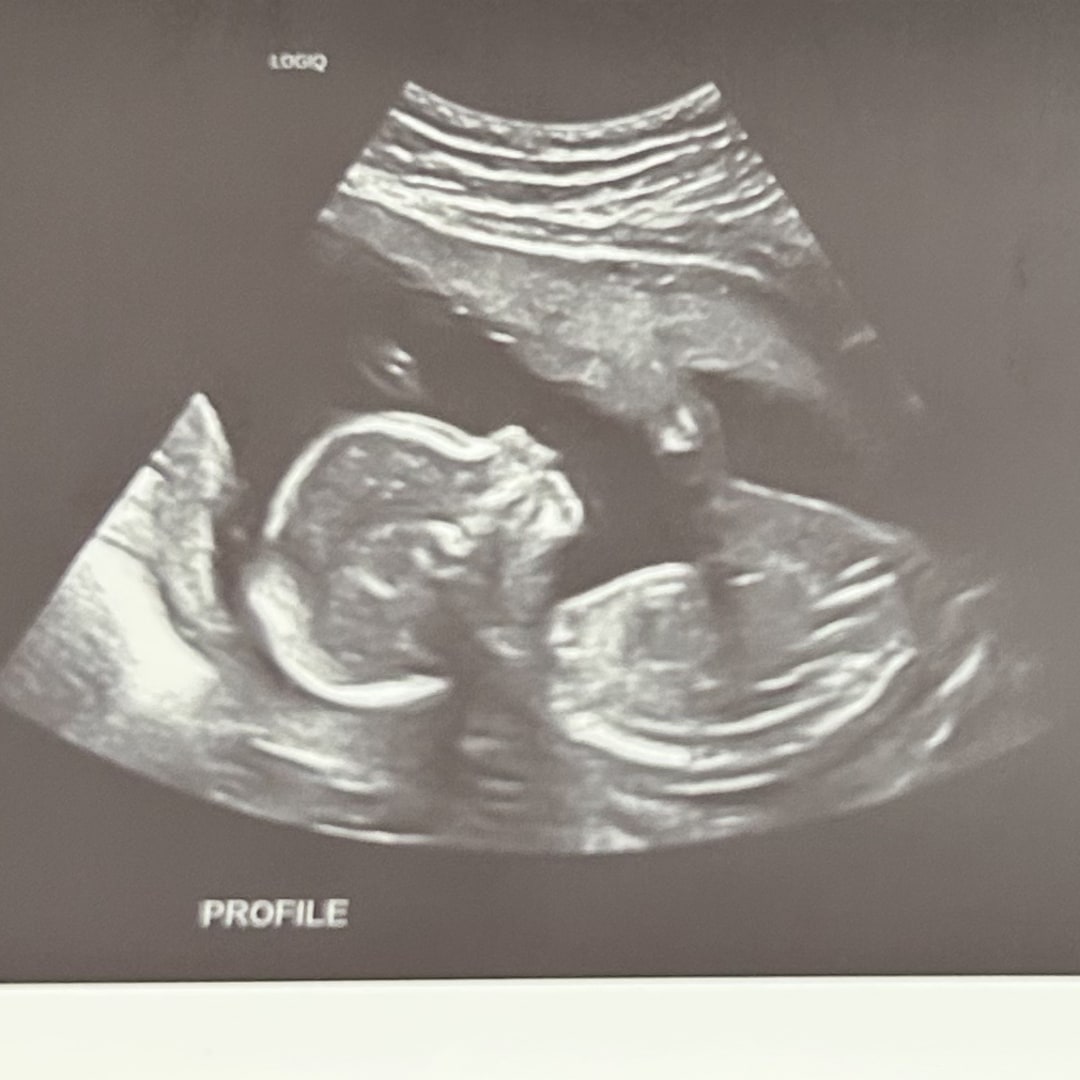 Photo shared by Anahi for their Babylist baby registry.