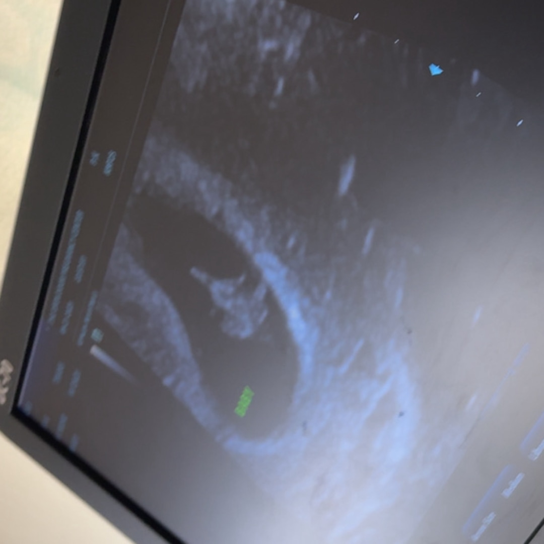 Photo shared by Kaele for their Babylist baby registry.