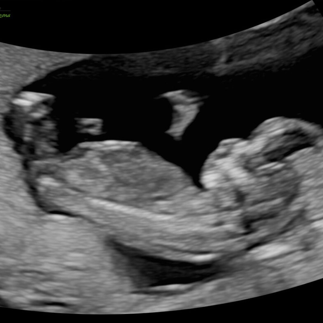 Photo shared by Hannah for their Babylist baby registry.