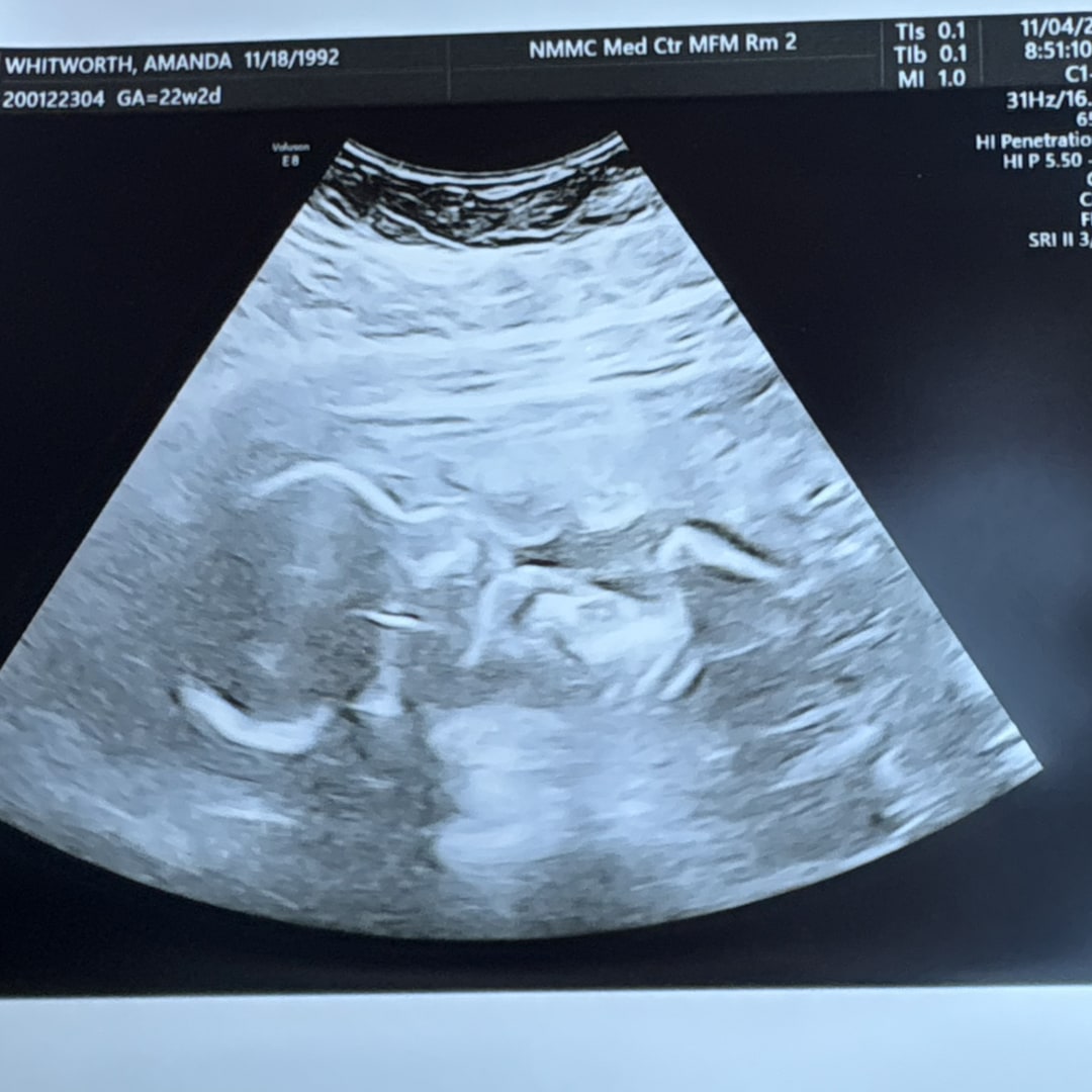 Photo shared by Amanda for their Babylist baby registry.