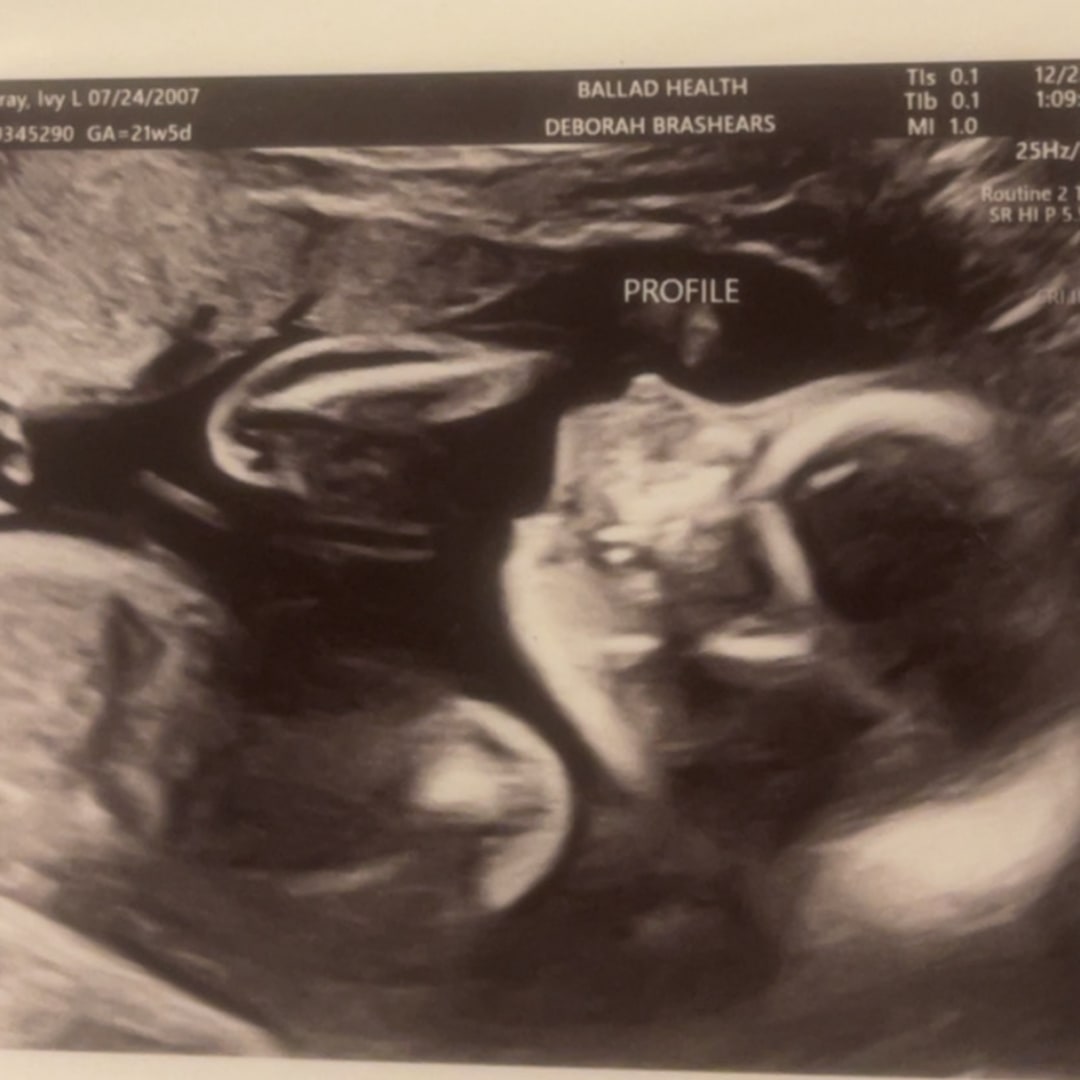 Photo shared by Ivy for their Babylist baby registry.