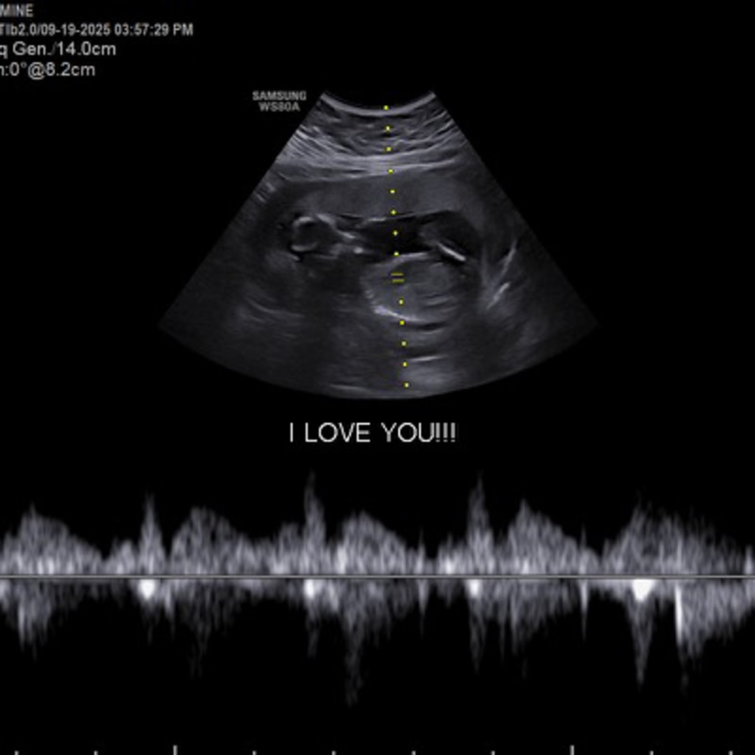 Photo shared by Jasmine for their Babylist baby registry.