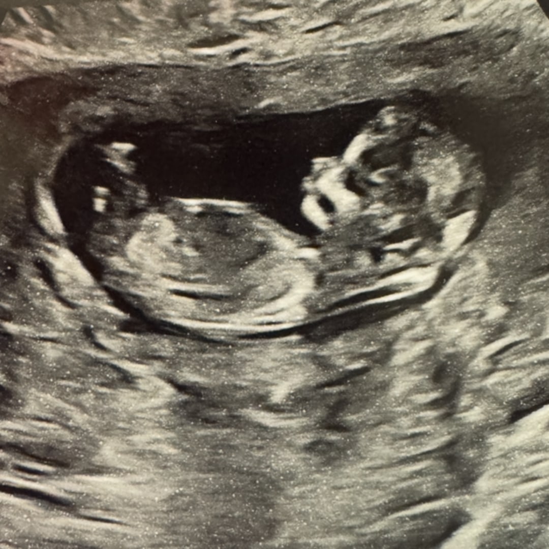 Photo shared by Viktoriya for their Babylist baby registry.