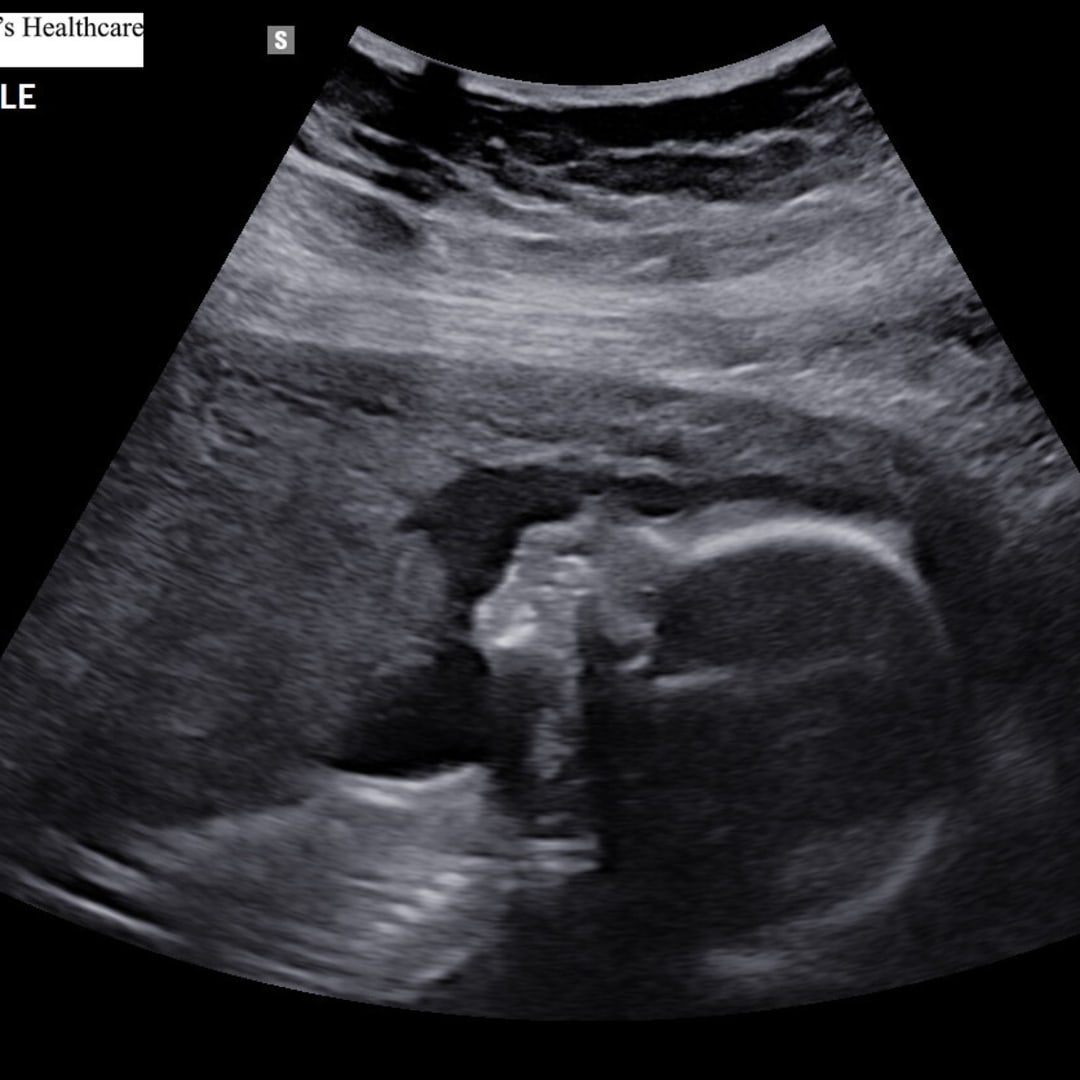 Photo shared by Alyssa for their Babylist baby registry.