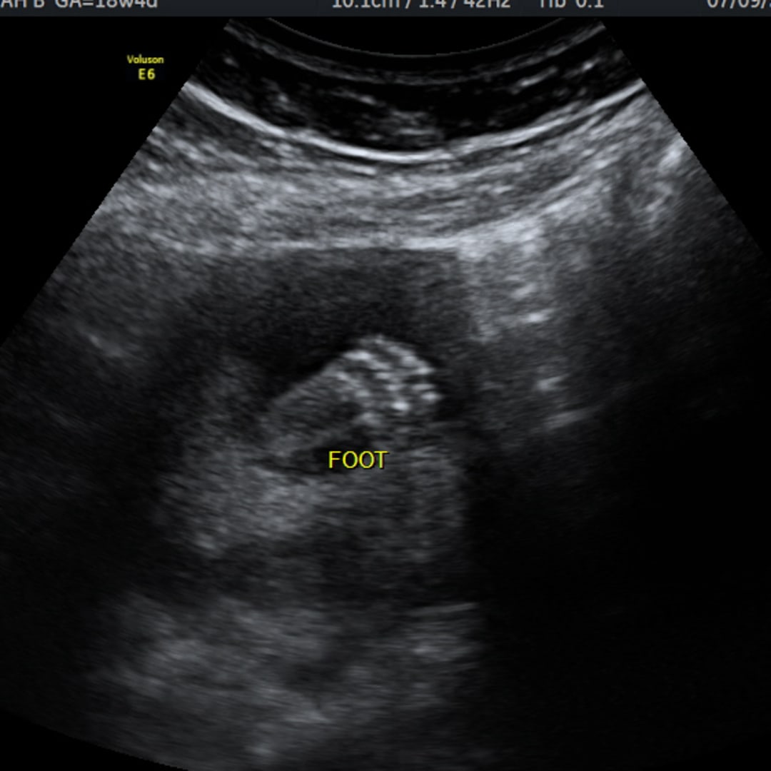 Photo shared by Hannah for their Babylist baby registry.