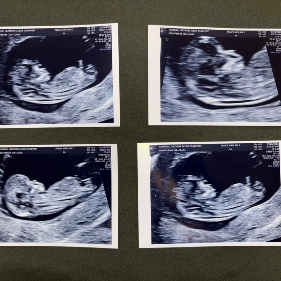 Photo shared by Jazzmine for their Babylist baby registry.