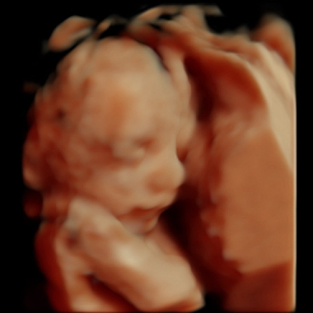 Photo shared by Briley for their Babylist baby registry.