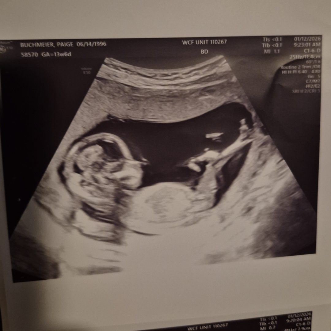 Photo shared by Paige for their Babylist baby registry.