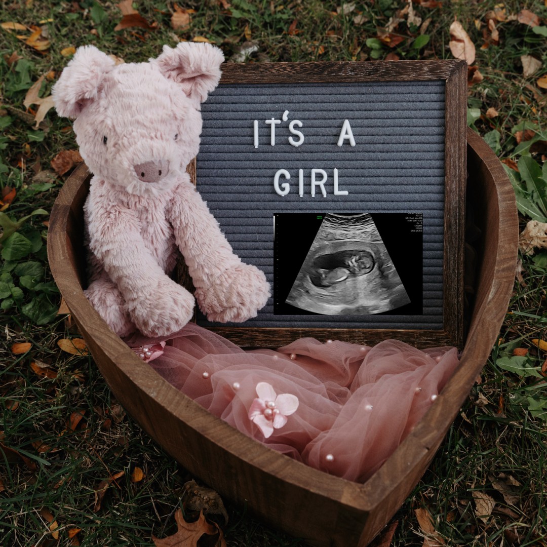 Photo shared by Erica for their Babylist baby registry.