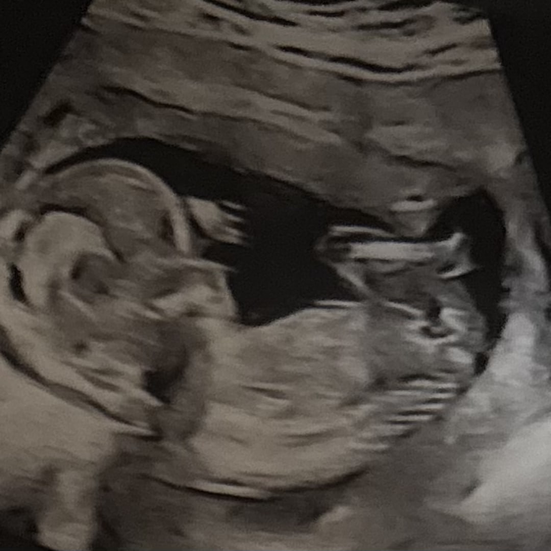 Photo shared by Michelle for their Babylist baby registry.